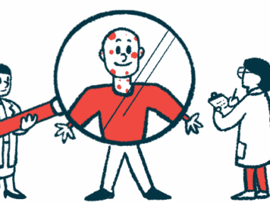 Clinicians in white coats hold up a giant magnifying glass to a patient as part of a case study into the disease.